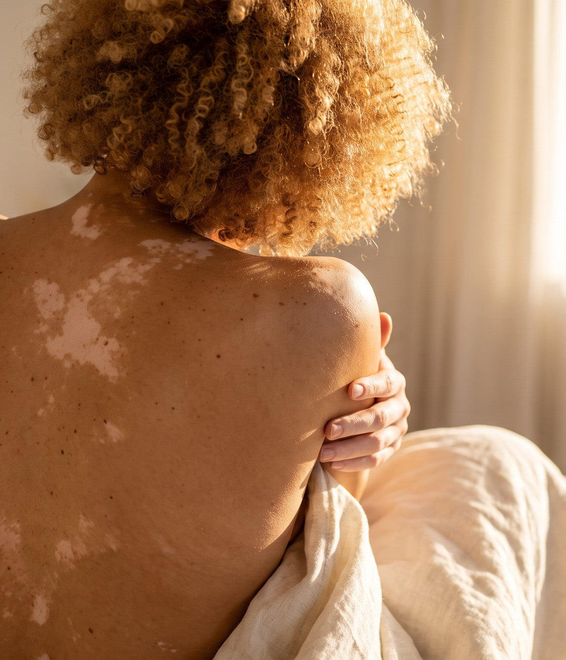 Woman embracing herself, back turned, morning light, vitiligo visible on her back